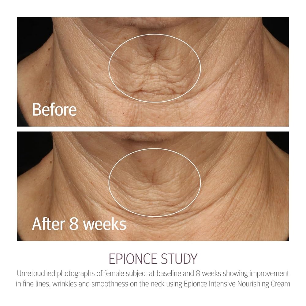 Crema nutriente intensiva Epionce - Crema idratante antietà per viso, collo e decolleté, per tutti i tipi di pelle con ceramidi, glicerina e squalene, Dermatologist Skincare