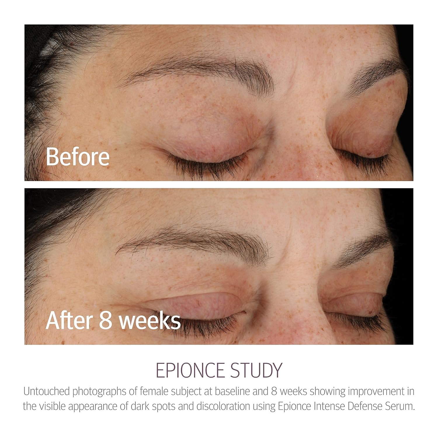 Epionce Intense Defense Serum - Anti-Aging Facial Serum with Vitamin C, Vitamin E, Vitamin D, A, B,  Niacinamide, Dermatologist Skincare · v6