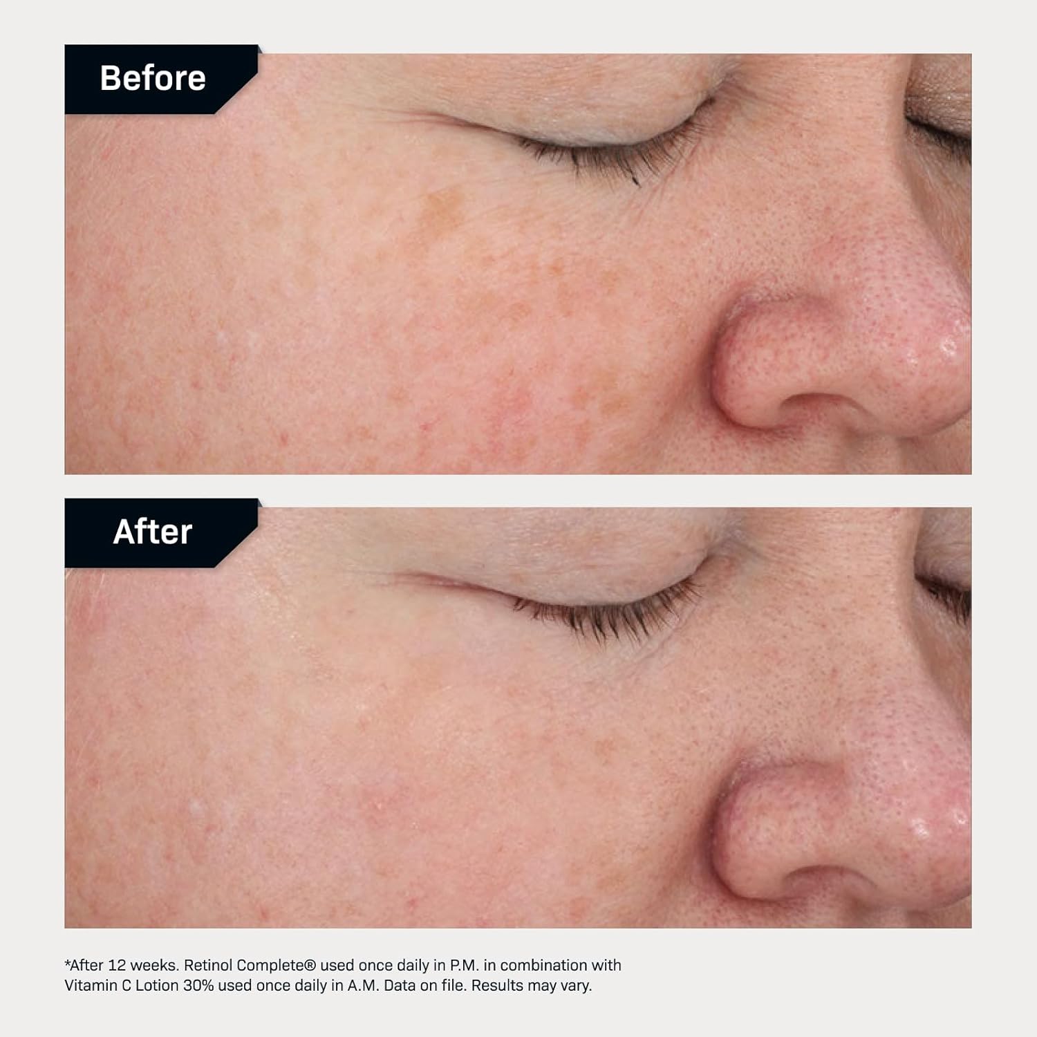 Revision Skincare Retinol Complete® 0.5 Serum przeciwstarzeniowe, redukuje drobne linie i zmarszczki, nawilża i wygładza