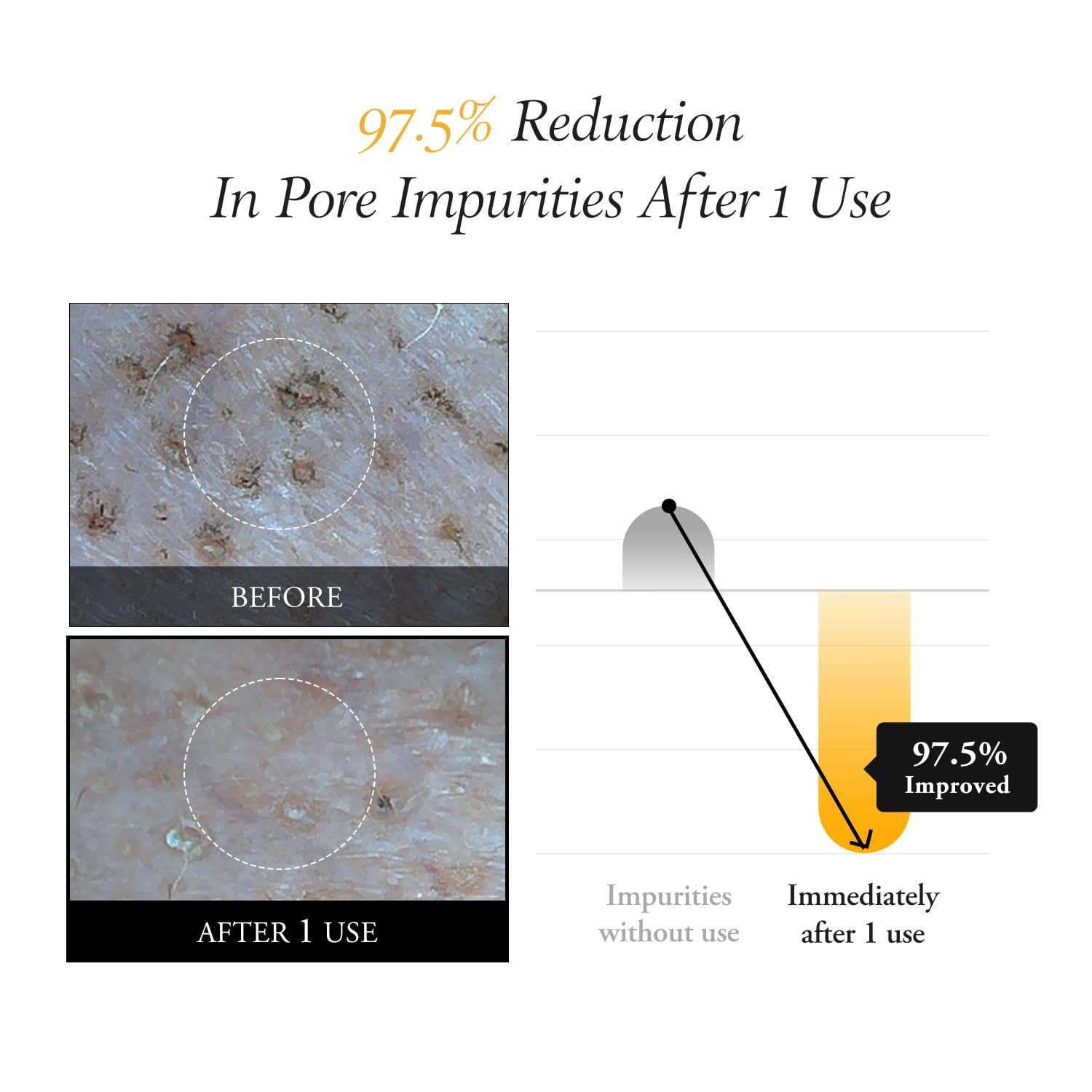 Aprilskin Calendula Peel Off Facial Mask | Glass Skin | Vegan | Blackhead Care | Exfoliating, Resurfacing | PHA BHA | Korean Skincare | K Beauty | 3.52 oz · v3