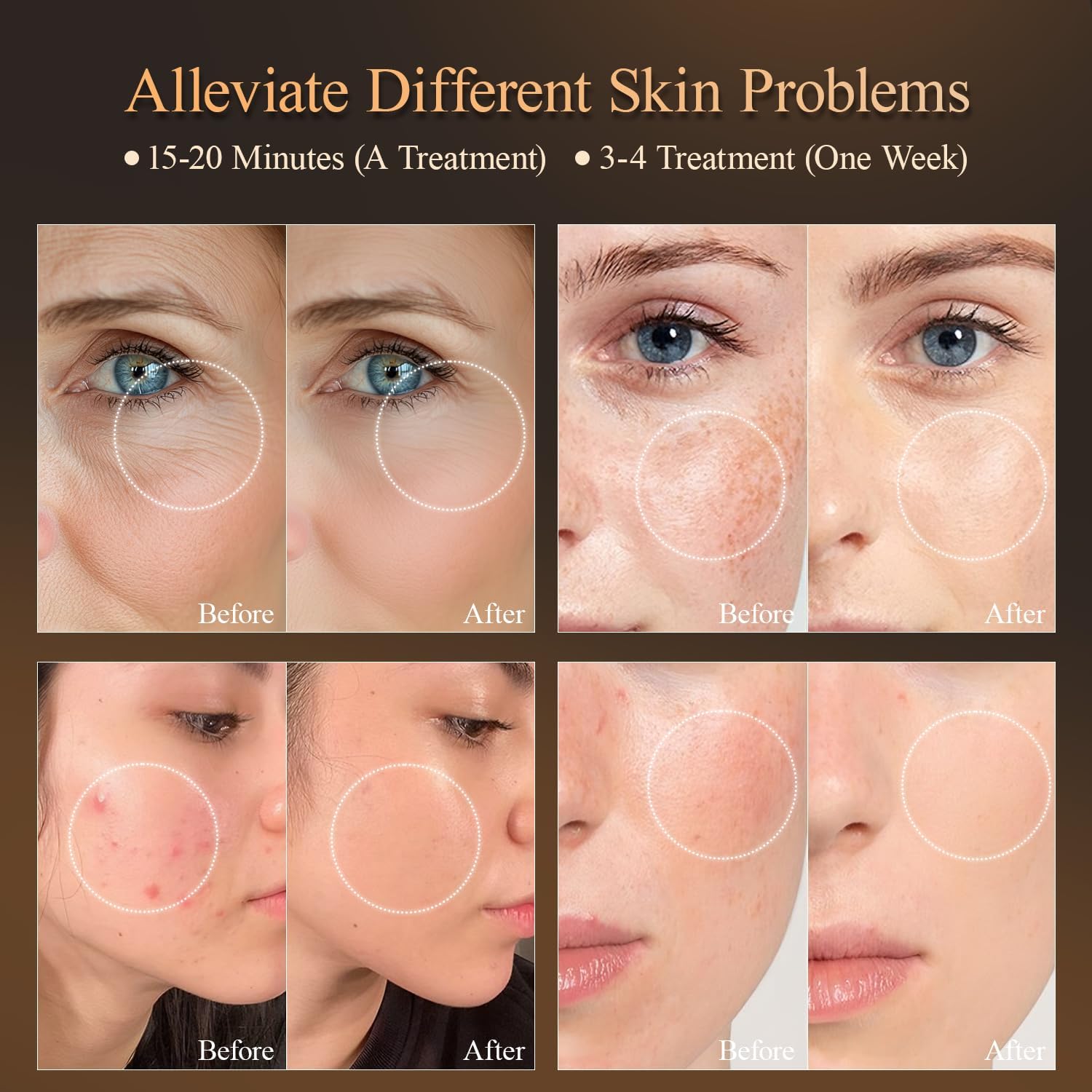 LED-Lichttherapie-Gesichtsmaske mit 7 Farben, Gesichtslichttherapie-Maske für Gesicht, Aknereduzierung, Anti-Aging, Falten reduzieren, glatte Haut, Hautverjüngung mit Infrarotlicht, Weiß, L-Maske