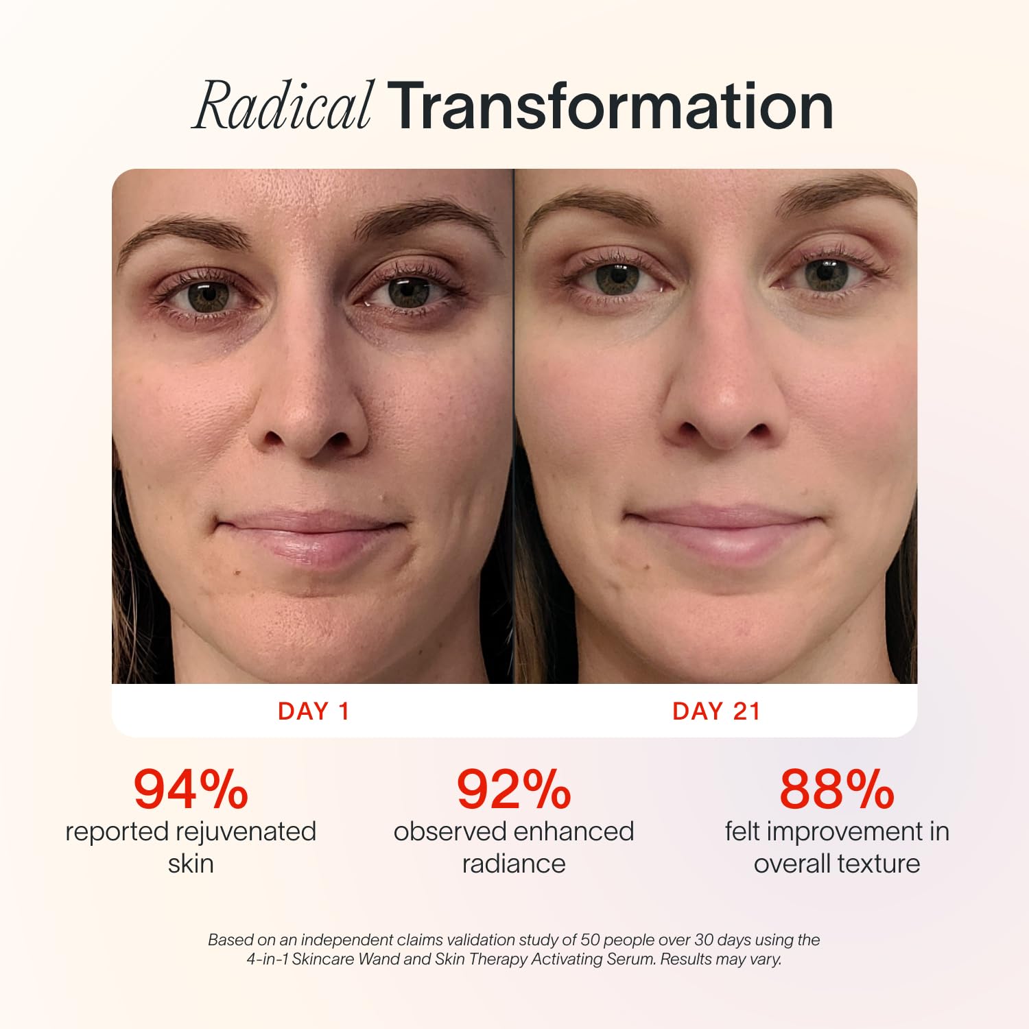 Pacchetto siero per la terapia della pelle con bacchetta facciale Radiant Renewal 4 in 1 Solawave | Terapia con luce rossa per viso e collo | Bacchetta e massaggiatore galvanici per la cura della pelle | Riduzione delle rughe antietà | Solawave Original