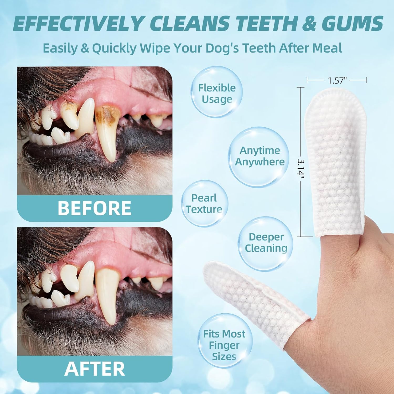 Dog Teeth Cleaning Wipes - Pet Dental Finger Wipes for Dogs  Cats - Dog Tooth Brushing Kit Dental Wipes - Reduces Plaque amp; Freshens Breath 50Pcs · v9