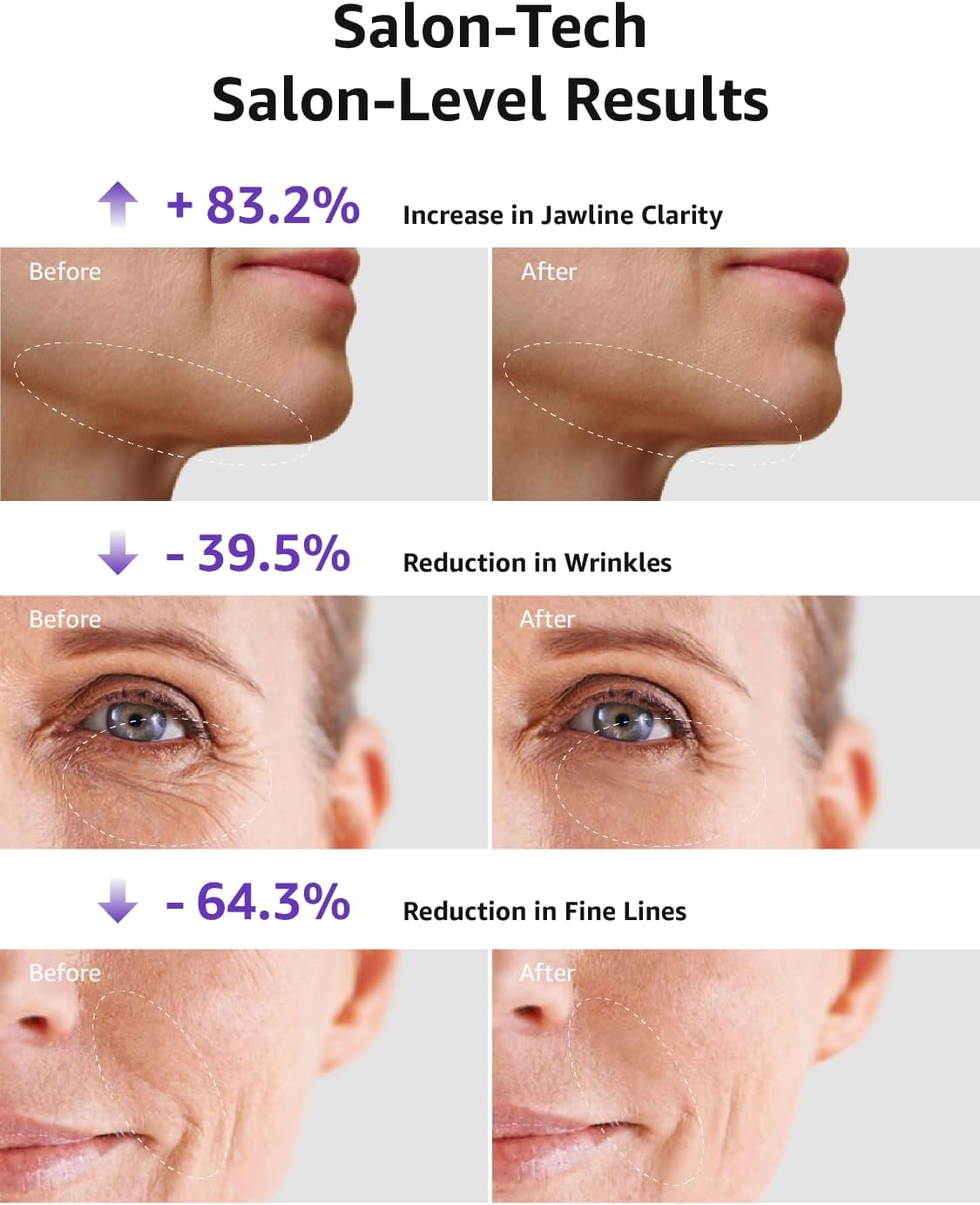 Skin Tightening Face Machine, Facial Massager Light Therapy for Face, 3 in 1 Microcurrent Facial Device Home Use Anti-Aging Device, 5 Level for Facial Firming, Wrinkle, Lifting, Toning, Glow Boost · v8