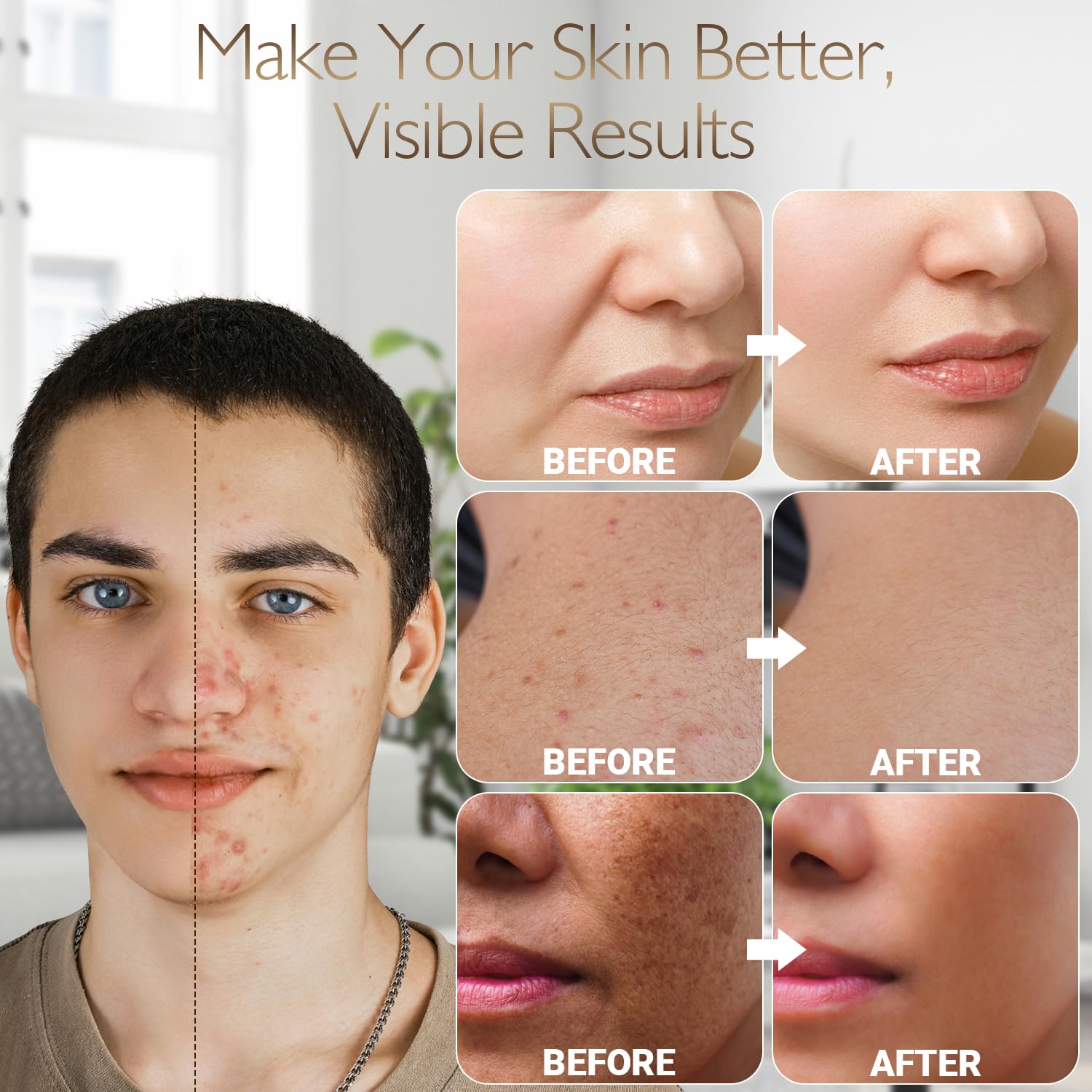 Home Use Microneedling Microneedle Skin Care Beauty Kit Tool for Face Hair Beard (0.25mm) · v3