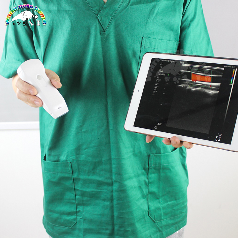 Color Doppler Wireless Probe 128 elements 3 in 1 Convex/Linear/Phased Probe Transducer Double Head