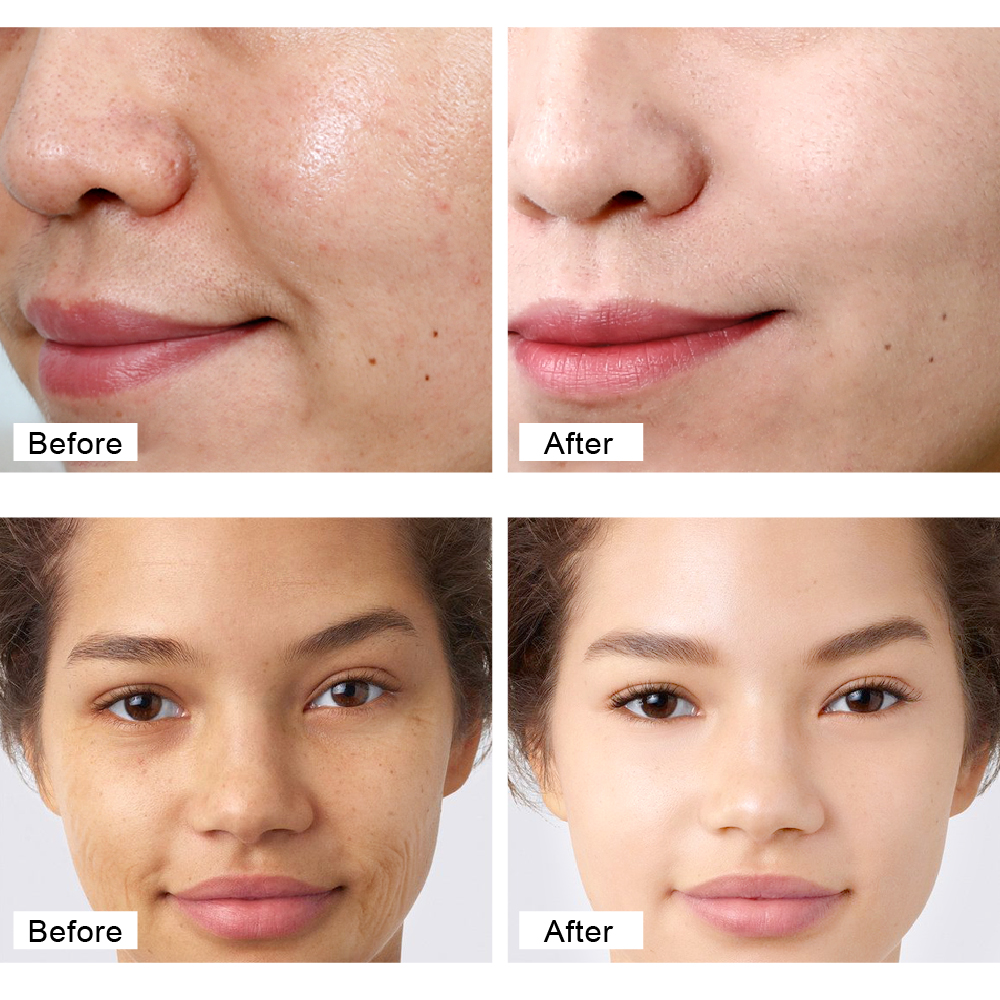 Kem chống lão hóa sống động mặt Retinol loại bỏ Wrinkle Firming nâng làm trắng ánh sáng kem dưỡng da mặt